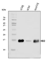 Anti-HBD Antibody Picoband® Boster Bio