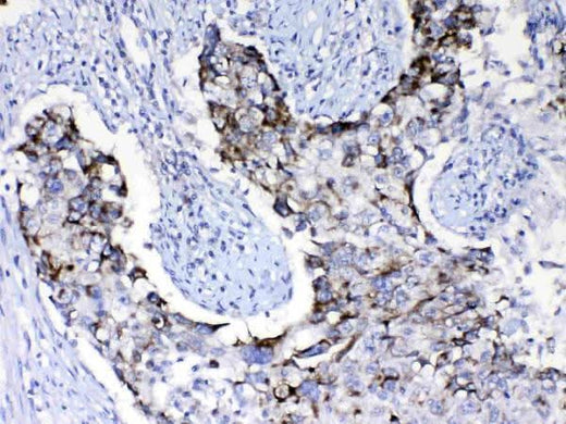 Anti-PI3 Kinase p110 beta/PIK3CB Antibody Picoband® Boster Bio