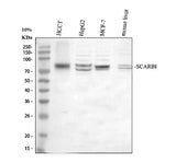 Anti-Scavenging Receptor SR-BI/SCARB1 Antibody Picoband® Boster Bio