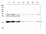 Anti-TSLP Antibody Picoband® Boster Bio