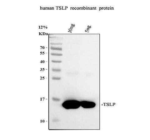 Anti-TSLP Antibody Picoband® Boster Bio