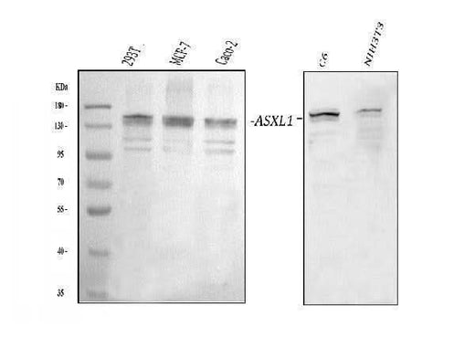 Anti-ASXL1 Antibody Picoband® Boster Bio