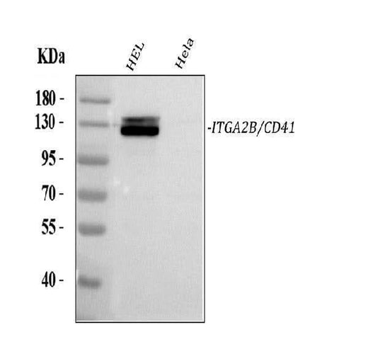 Anti-CD41/Integrin Alpha 2B/ITGA2B Antibody Picoband® Boster Bio