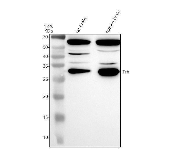 Anti-Trh Antibody Picoband® Boster Bio