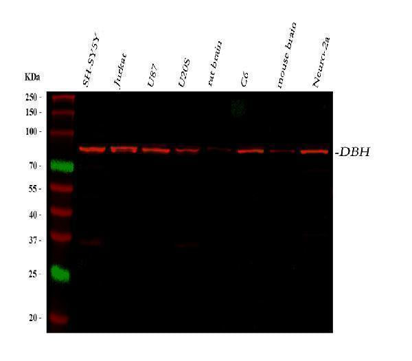 Anti-Dopamine beta Hydroxylase/DBH Antibody Picoband® Boster Bio