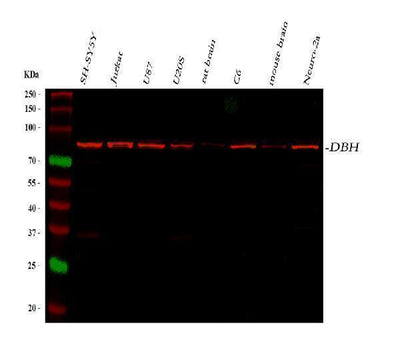 Anti-Dopamine beta Hydroxylase/DBH Antibody Picoband® Boster Bio