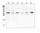 Anti-CD40L/CD40LG Antibody Picoband® Boster Bio