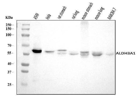 Anti-ALDH3A1 Antibody Picoband® Boster Bio