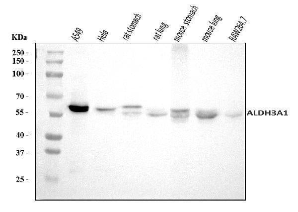 Anti-ALDH3A1 Antibody Picoband® Boster Bio