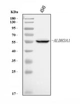 Anti-ALDH3A1 Antibody Picoband® Boster Bio