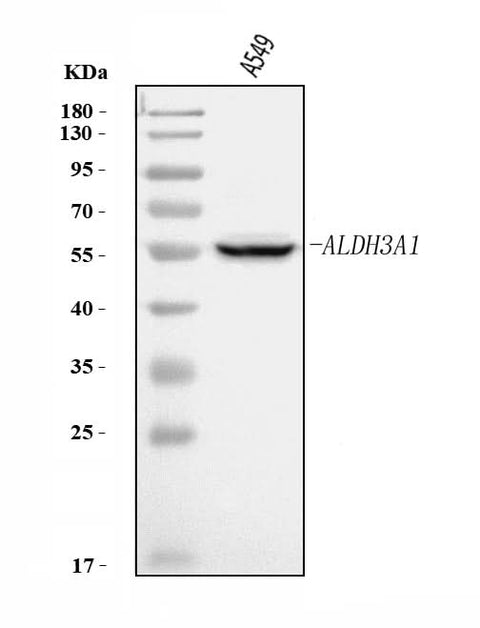 Anti-ALDH3A1 Antibody Picoband® Boster Bio