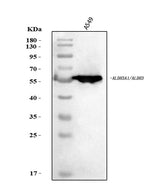 Anti-ALDH3A1 Antibody Picoband® Boster Bio