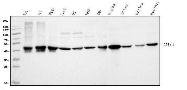 Anti-ornithine aminotransferase/OAT Antibody Picoband® Boster Bio