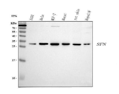 Anti-14-3-3 sigma/SFN Antibody Picoband® Boster Bio