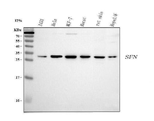 Anti-14-3-3 sigma/SFN Antibody Picoband® Boster Bio