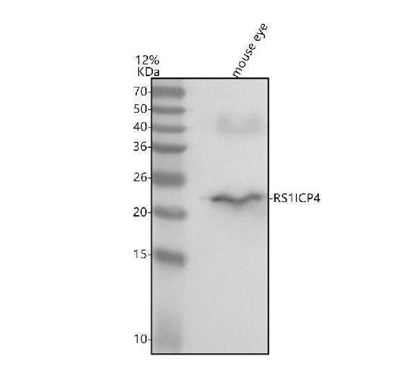 Anti-RS1 Antibody Picoband® Boster Bio