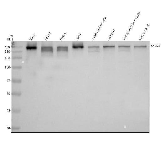 Anti-SCN4A Antibody Picoband® Boster Bio