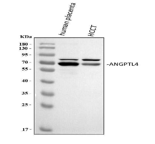 Anti-Angiopoietin-like 4/ANGPTL4 Antibody Picoband® Boster Bio