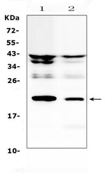 Anti-IL11 Antibody Picoband® Boster Bio