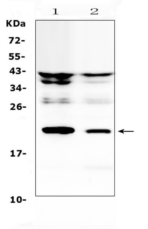 Anti-IL11 Antibody Picoband® Boster Bio