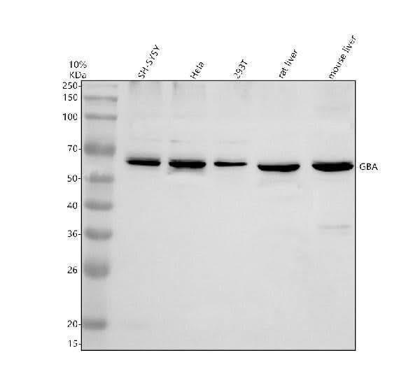 Anti-GBA/GBA1 Antibody Picoband® Boster Bio