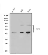Anti-p75 NGF Receptor/NGFR Antibody Picoband® Boster Bio