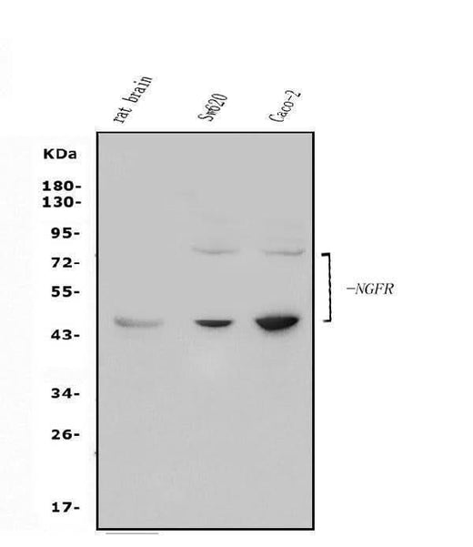 Anti-p75 NGF Receptor/NGFR Antibody Picoband® Boster Bio