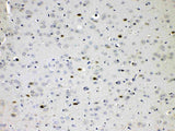 Anti-Choline Acetyltransferase/CHAT Antibody Picoband® Boster Bio
