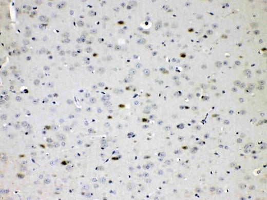 Anti-Choline Acetyltransferase/CHAT Antibody Picoband® Boster Bio