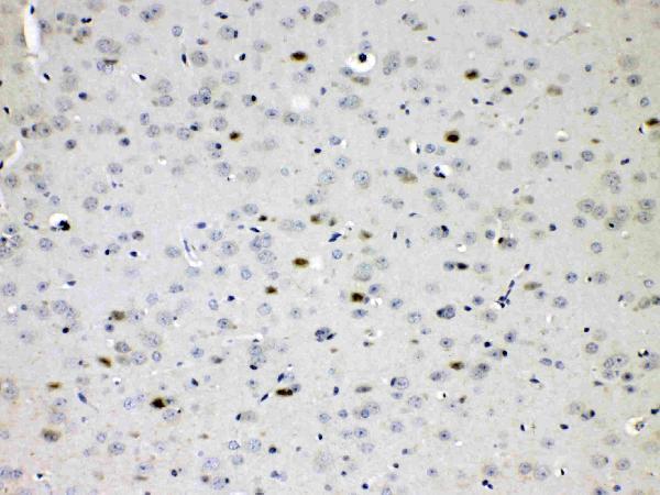Anti-Choline Acetyltransferase/CHAT Antibody Picoband® Boster Bio
