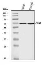 Anti-Choline Acetyltransferase/CHAT Antibody Picoband® Boster Bio
