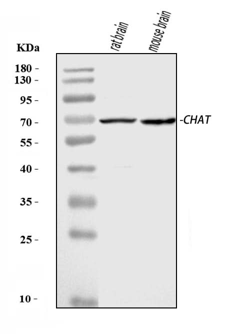 Anti-Choline Acetyltransferase/CHAT Antibody Picoband® Boster Bio