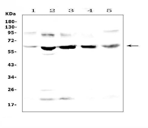 Anti-Steroid sulfatase/STS Antibody Picoband® Boster Bio