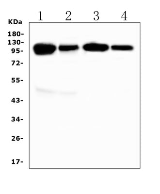 Anti-VCAM1 Antibody Picoband® Boster Bio