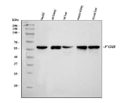 Anti-Fibrinogen beta chain/FGB Antibody Picoband® Boster Bio