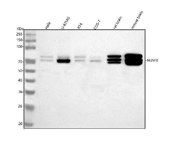 Anti-NUMB Antibody Picoband® Boster Bio