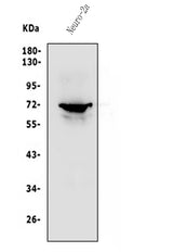 Anti-P2RX7 Antibody Picoband® Boster Bio