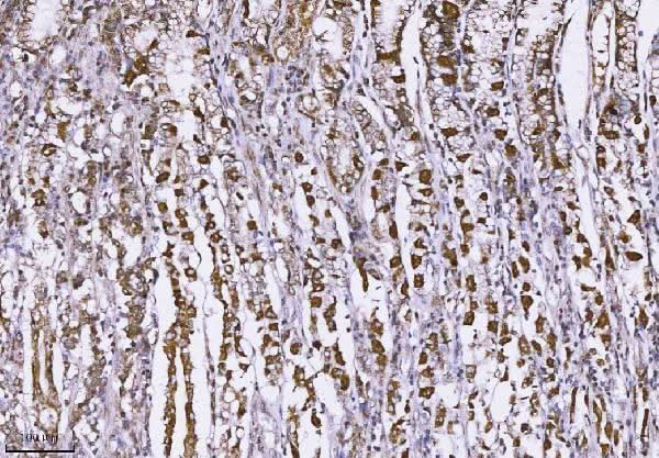 Anti-MUC2 Antibody Boster Bio