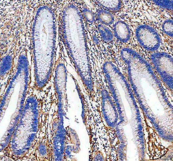 Anti-BIGH3/TGFBI Antibody Picoband® Boster Bio