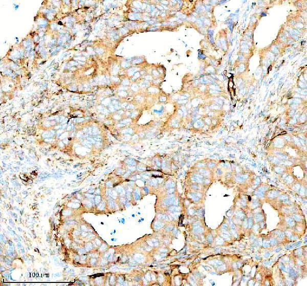 Anti-SERPING1/C1 Antibody Picoband® Boster Bio