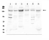 Anti-HDAC5 Antibody Picoband® Boster Bio