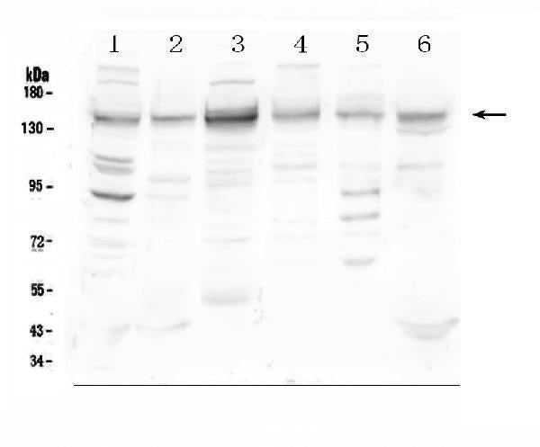 Anti-HDAC5 Antibody Picoband® Boster Bio