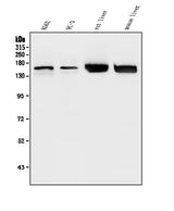 Anti-HDAC5 Antibody Picoband® Boster Bio