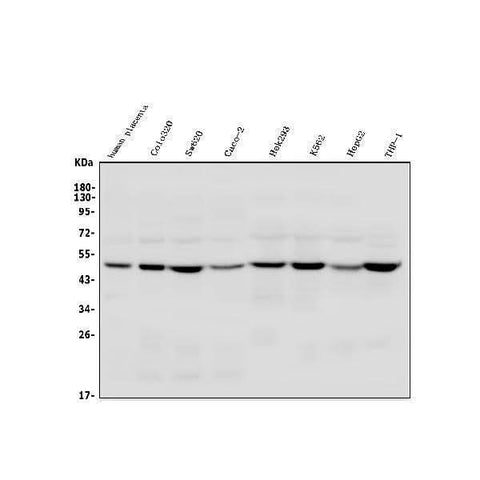 Anti-TSG101 Antibody Picoband® Boster Bio