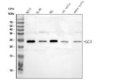 Anti-Grancalcin/GCA Antibody Picoband® Boster Bio
