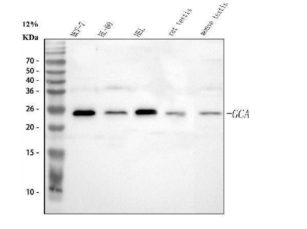 Anti-Grancalcin/GCA Antibody Picoband® Boster Bio