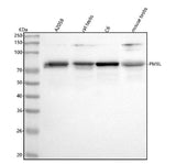 Anti-Melanoma gp100/PMEL Antibody Picoband® Boster Bio