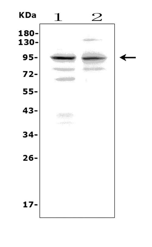 Anti-Melanoma gp100/Pmel Picoband® Antibody Boster Bio