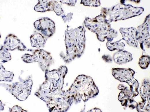 Anti-Diazepam Binding Inhibitor/DBI Antibody Picoband® Boster Bio