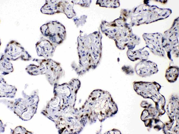 Anti-Diazepam Binding Inhibitor/DBI Antibody Picoband® Boster Bio